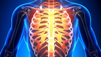 Thoracic Insufficiency treatment in jalandhar